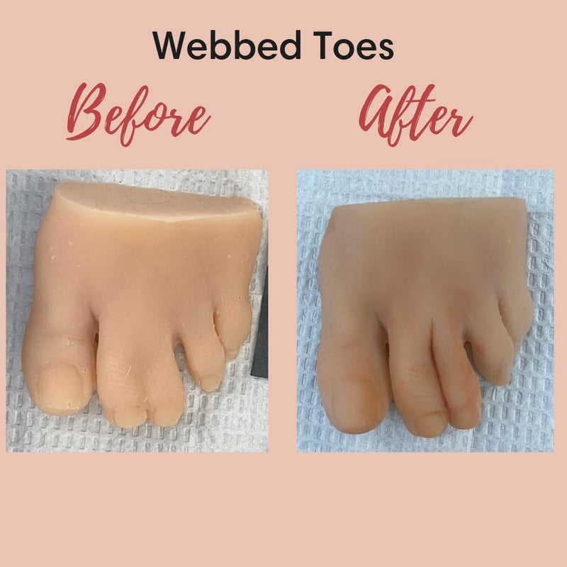 Webbed Toe Silicone For Practice